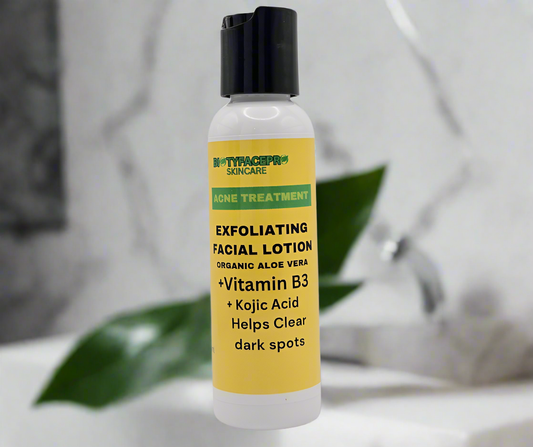 Acne Treatment Exfoliating Lotion